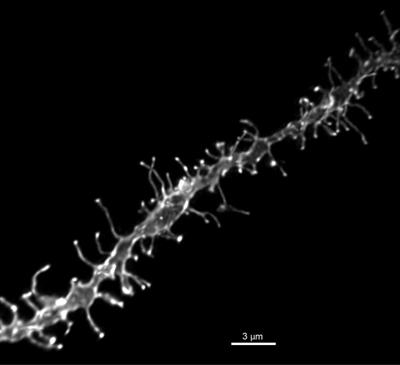 mGluR5 Mediates Dihydrotestosterone-Induced Nucleus Accumbens Structural Plasticity, but Not Conditioned Reward